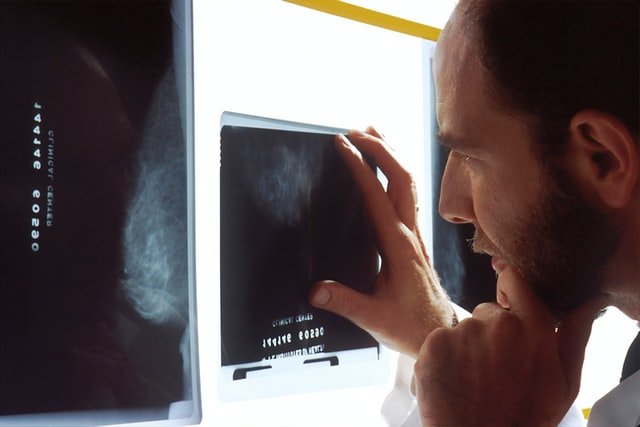 אבחון שגוי גידול סרטני בפרוסטטה, Prostate cancer
